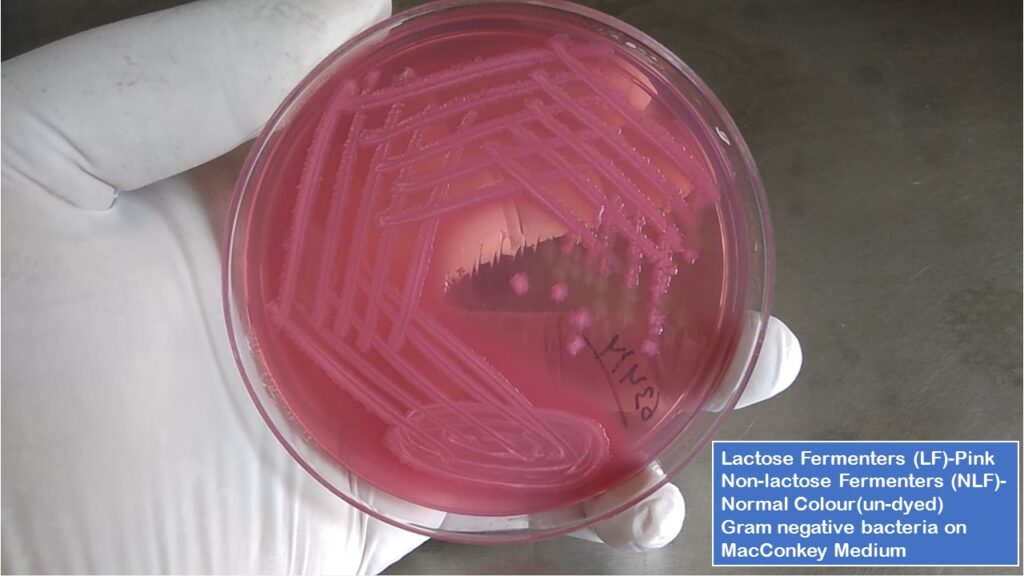 Lactose Fermenters (LF)-Pink, non-lactose fermenters (NLF)-normal Colour(un-dyed) Gram negative bacteria on MacConkey medium demonstration