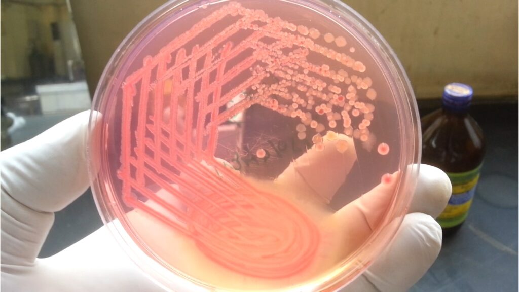 Mixed growth of bacteria on MacCkoney agar of isolated colony