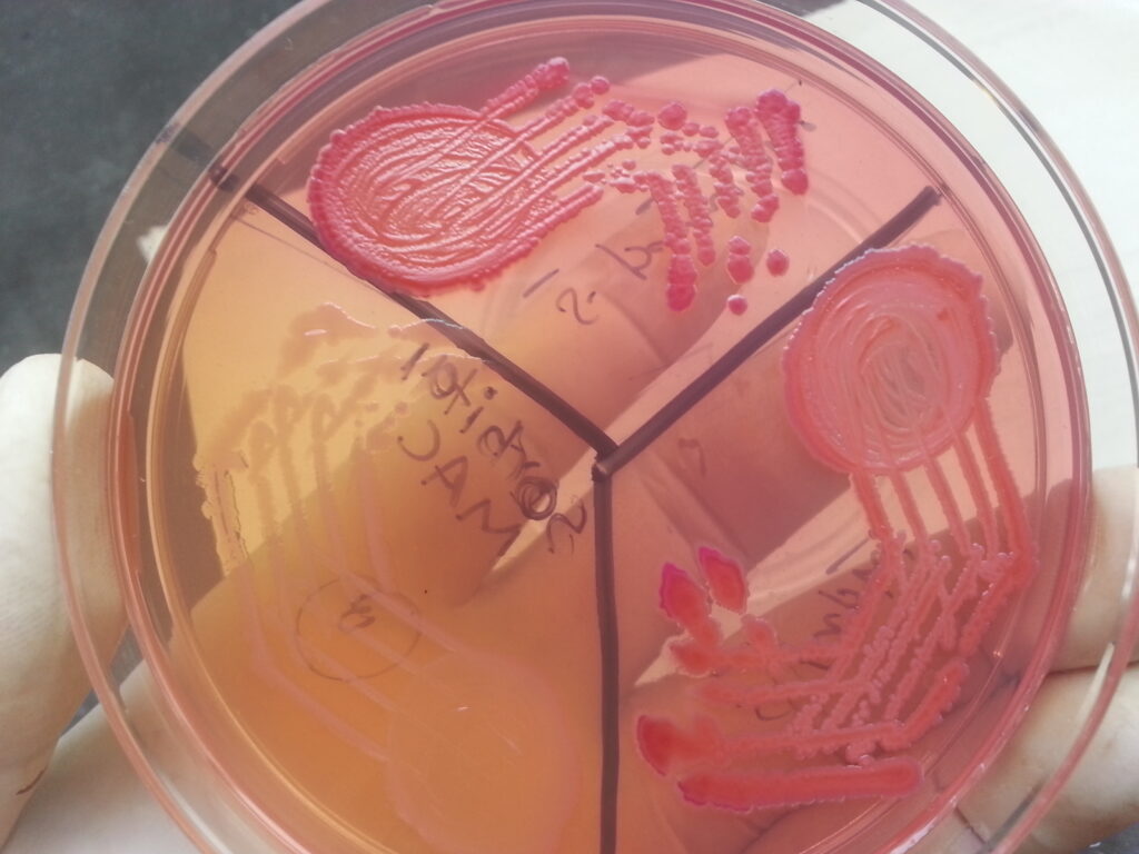 Salmonella Typhi, Salmonella Paratyphi and Shigella flexneri (non-fermenter) colony morphology on Sorbitol MacConkey agar
