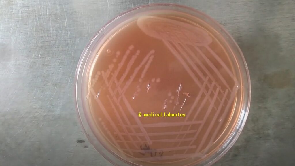 Shigella boydii  non-lactose fermenter colonies on MacConkey agar 