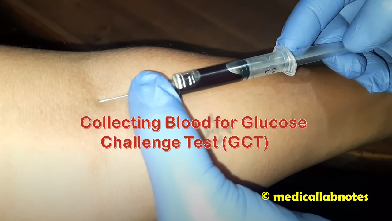 Glucose Challenge Test (GCT):Introduction, Procedure, Result-Interpretation, and Keynotes