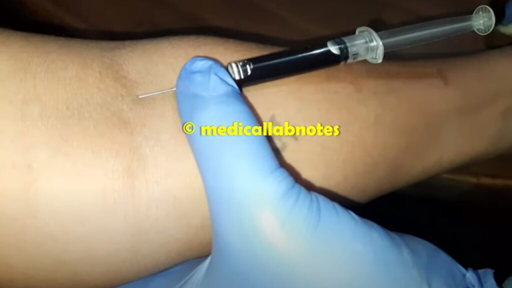 HLA-B27 Test- Introduction, Result-Interpretation, Clinical Significance, and Keynotes