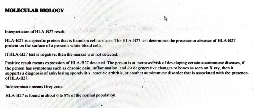 Interpretation of HLA-B27 Result