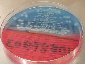 CLED Agar: Introduction, Composition, Principle, Preparation
