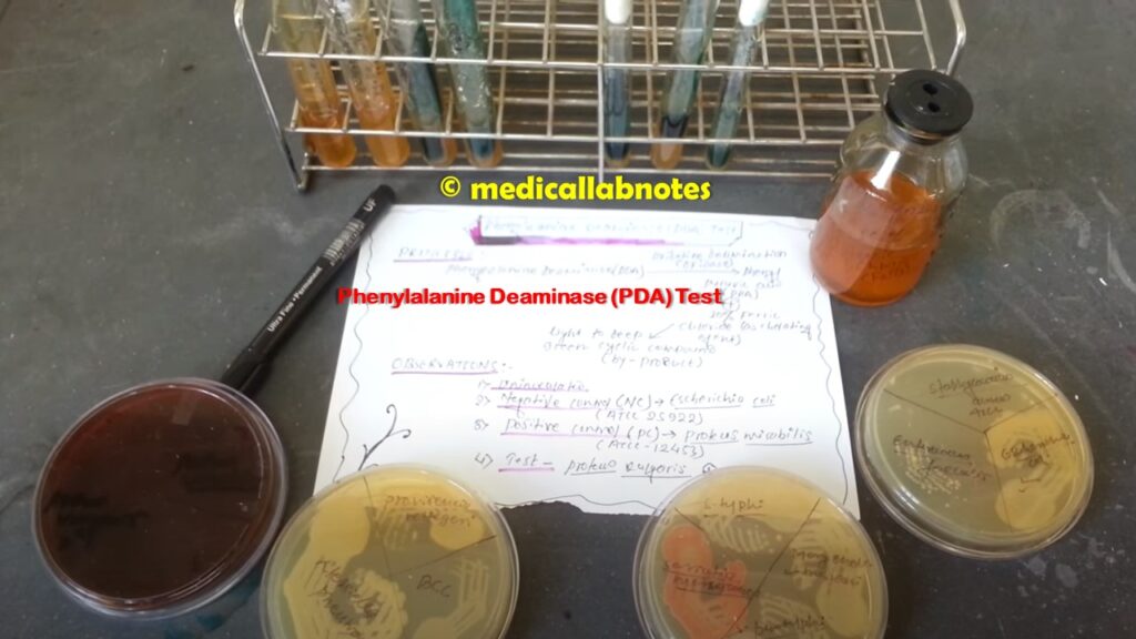 Phenylalanine Deaminase(PDA) Test- Introduction, Principle, Test Requirements, Procedure, Result- Interpretation, Keynotes, and Limitations
