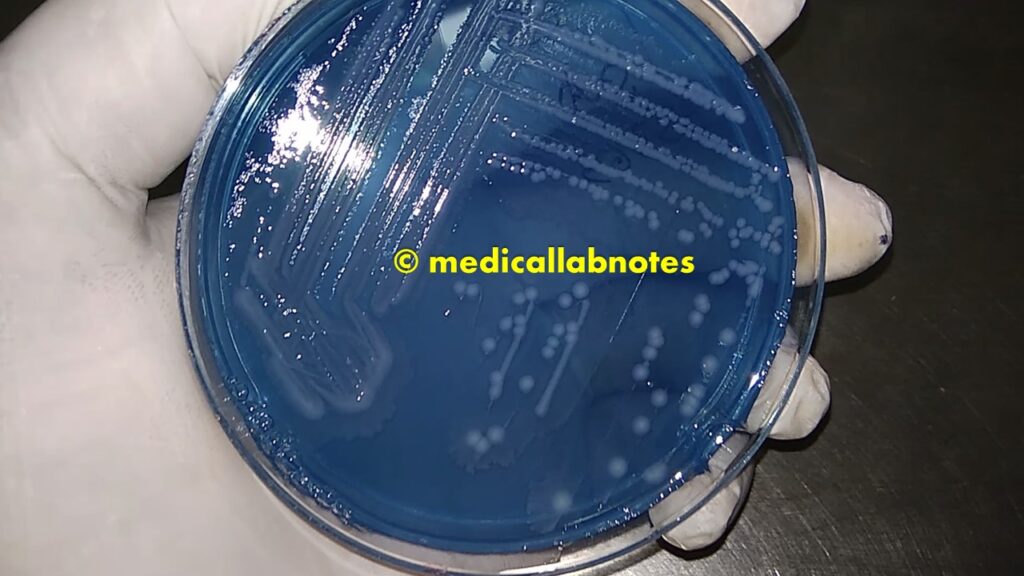 Proteus mirabilis green blue colony on CLED medium