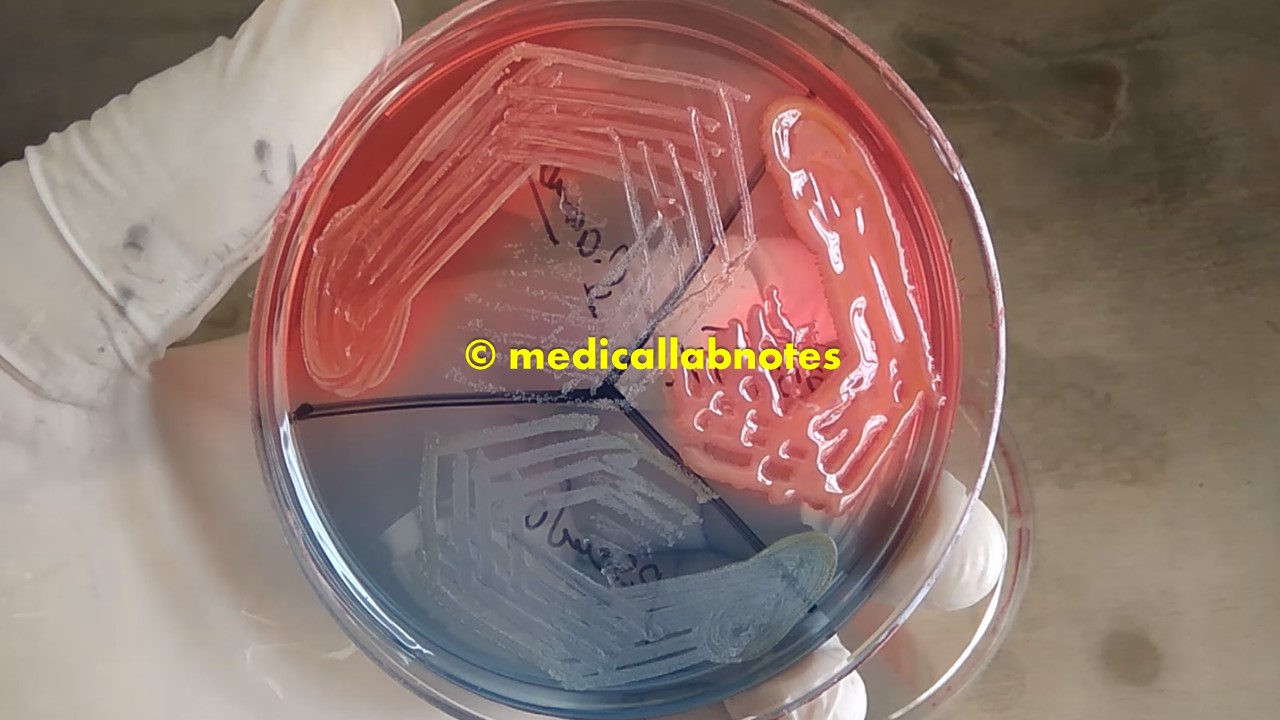 Cled Agar- Composition, Principle, Preparation, Results, Uses – DTQFP