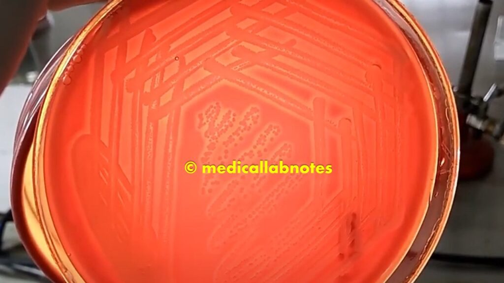 Staphylococcus aureus: Introduction, Pathogenicity, Lab Diagnosis, Treatment, and Keynotes