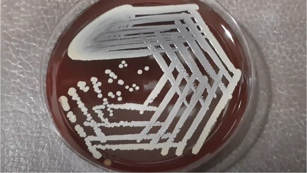 Staphylococcus aureus on blood agar