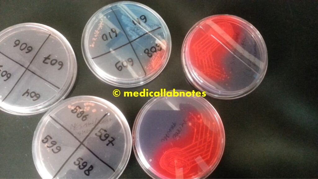Various microbial growth on CLED agar plates of urine culture