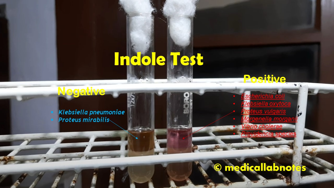 Indole test: Introduction, Principle, Test Requirements, Procedure, Result -Interpretation, and Keynotes