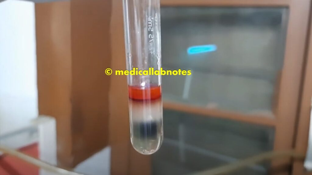 SIM test showing indole production, formation of hydrogen sulfide, and motility test positive