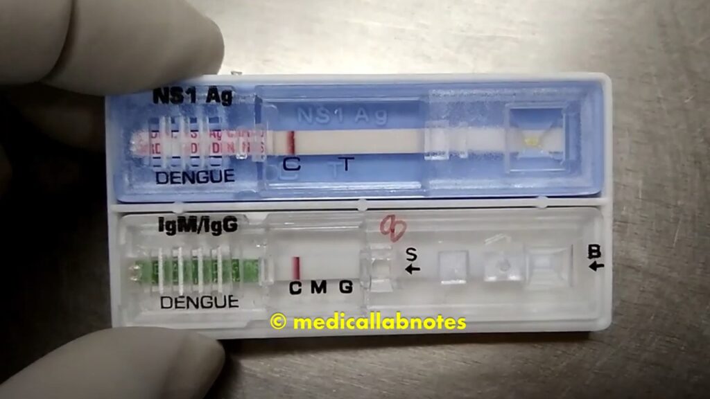 Dengue Rapid Test for IgM, IgG, and NS1 antigen Detection