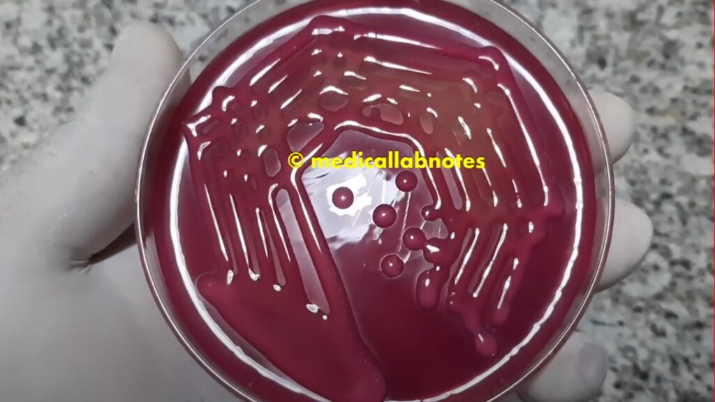 Mucoid lactose fermenter colonies of Klebsiella pneumoniae on Macconkey 