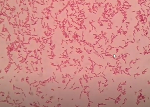 Gram-Negative Rod or Bacilli of E. coli