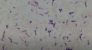 Exotoxins and Endotoxins: Introduction, Differences, and Keynotes
