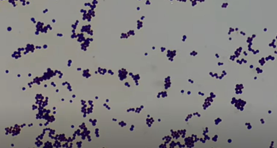 Gram-positive cocci of Staphylococcus aureus