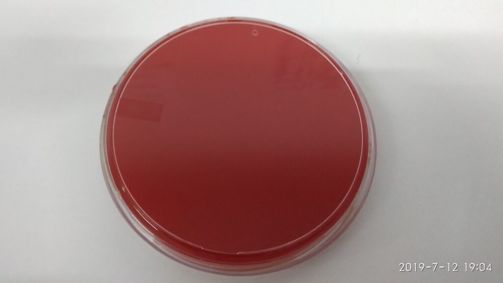 5% Sheep blood agar ( without inoculation of specimens)