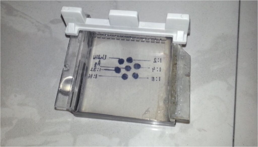 Agarose Gel Electrophoresis-Solidified gel in a casting tray