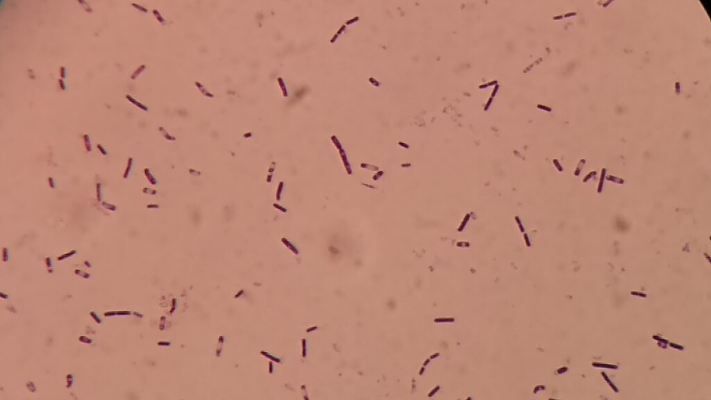 Bacillus in Gram staining