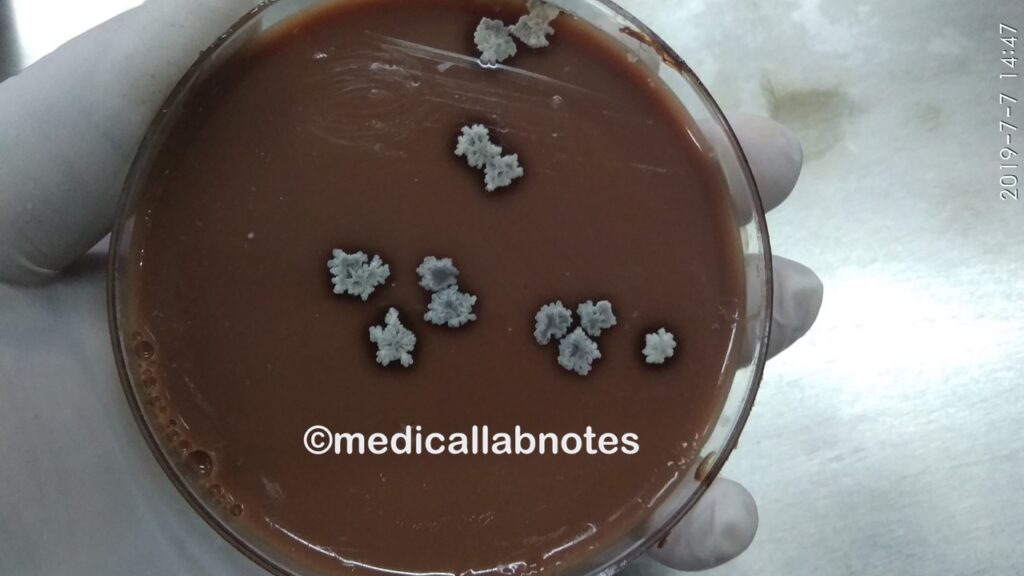 Bacillus species colony morphology on chocolate agar