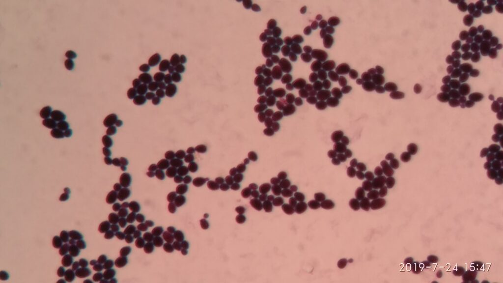 Candida in Gram staining
