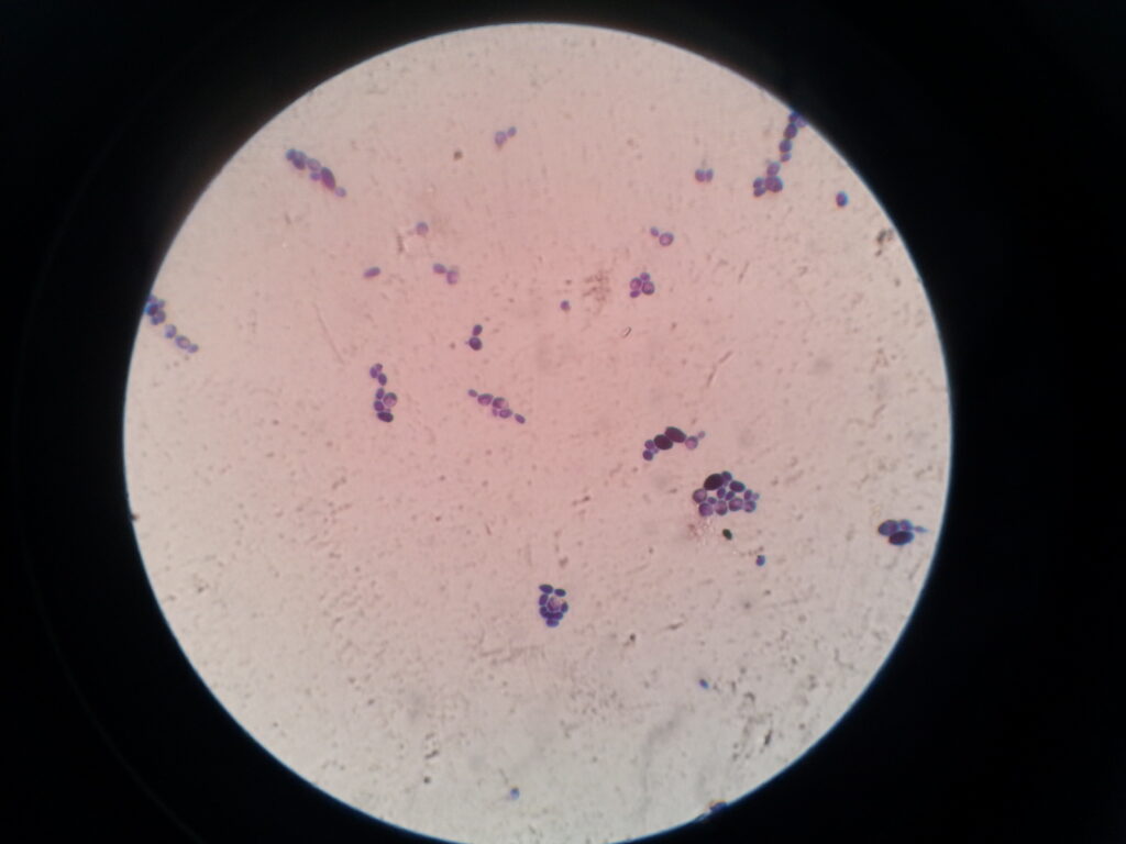Candida krusei yeast cells in Gram staining