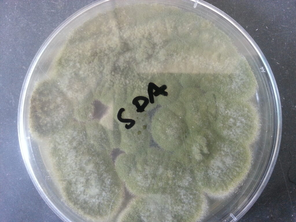 Colony characteristics of Aspergillus fumigatus on SDA