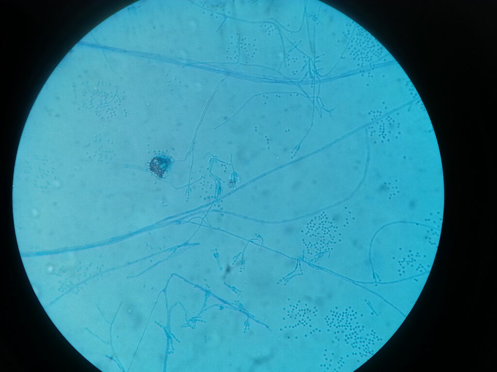 Conidia, branch and stipe of Paecilomyces Species