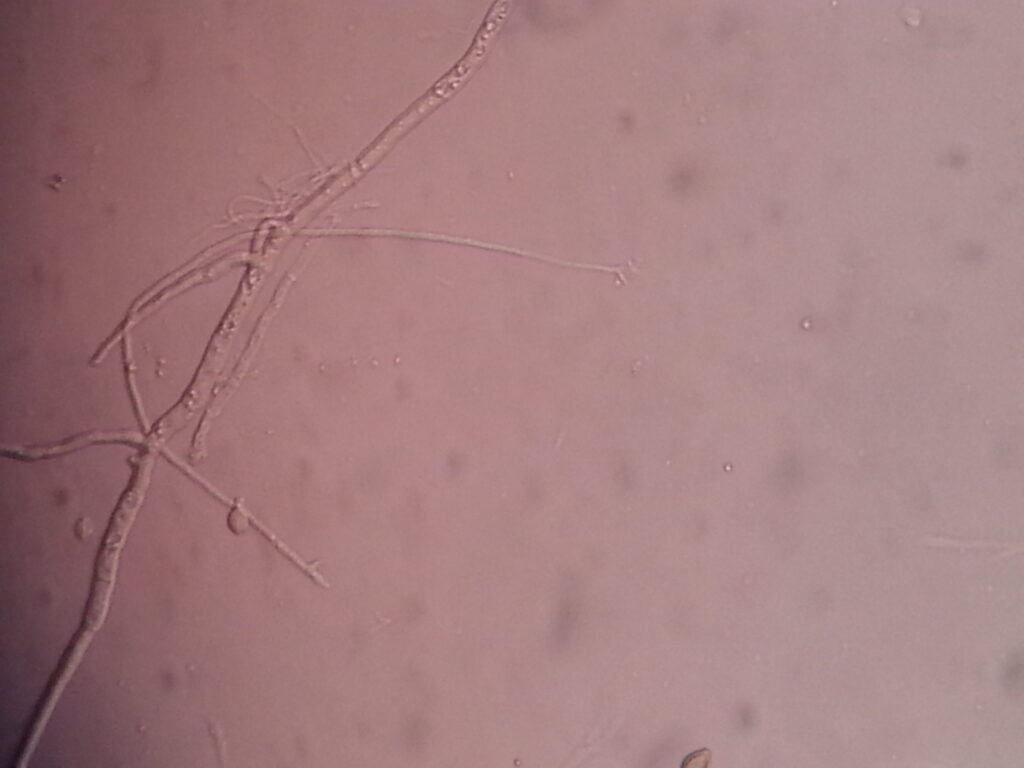 Conidia, germinated conidium and hyphae of Scedosporium
