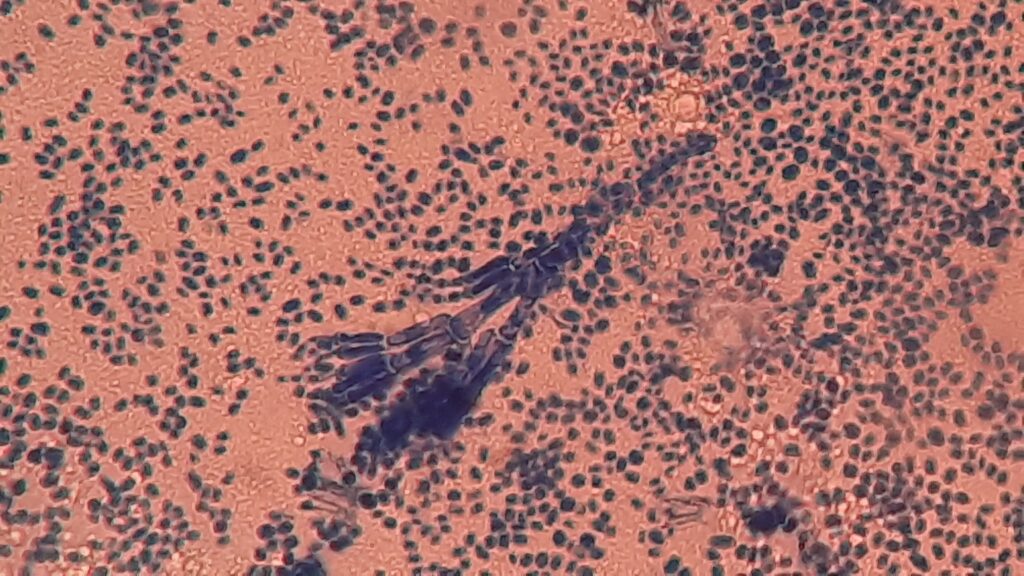 Conidia, phialides or sterigmata,metullae and conidiophore of Penicillium in LPCB tease mount microscopy