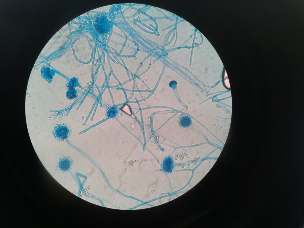 Conidia, phialides, vesicle, conidiophore, foot cell, hyphae and mycelium of Aspergillus fumigatus