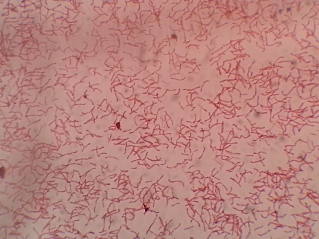 Coryneform bacteria in Neisser staining of culture