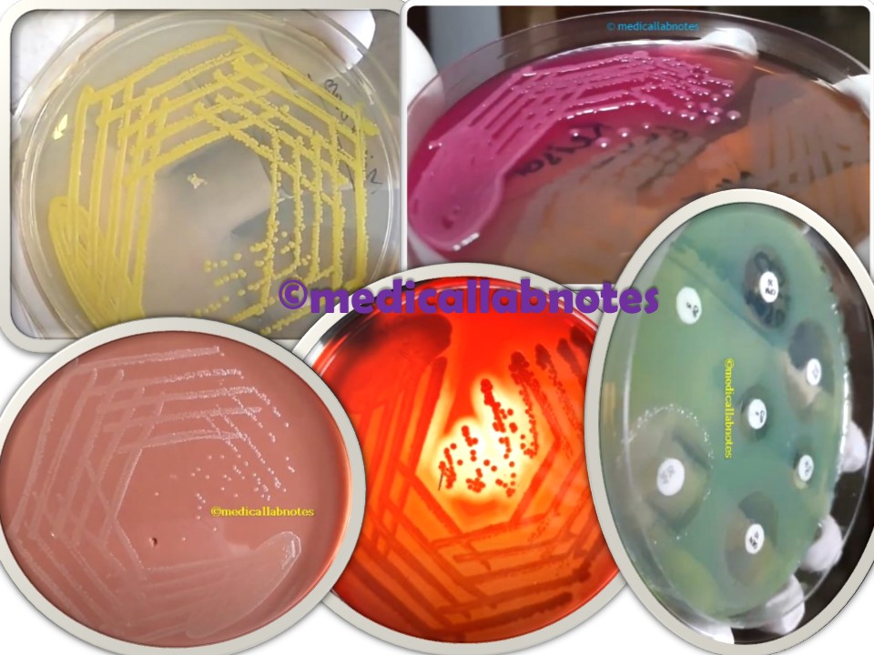 Culture media with variety of microbes-Micrococcus growth on nutrient agar (upper left), Lactose fermenting(Lf) and non-lactose fermenting (NLF) colonies of Gram negative bacteria colonies on MacConkey medium, Hameophilus influenzae colony morphology on chocolate agar(lower left), beta-hemolytic colonies of Staphylococcus aureus( middle), and Pseudomonas aeruginosa antibiogram pattern on Muller-Hinton agar(MHA)