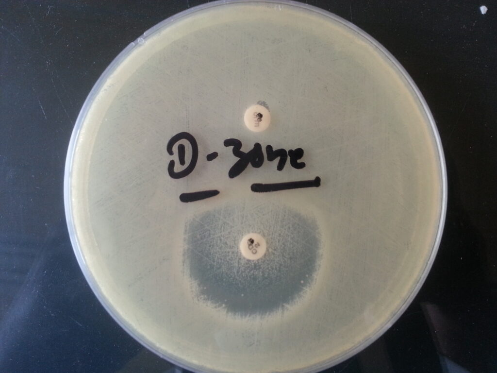 D-Zone test positive Staphylococcus aureus for detection of inducible clindamycin resistance
