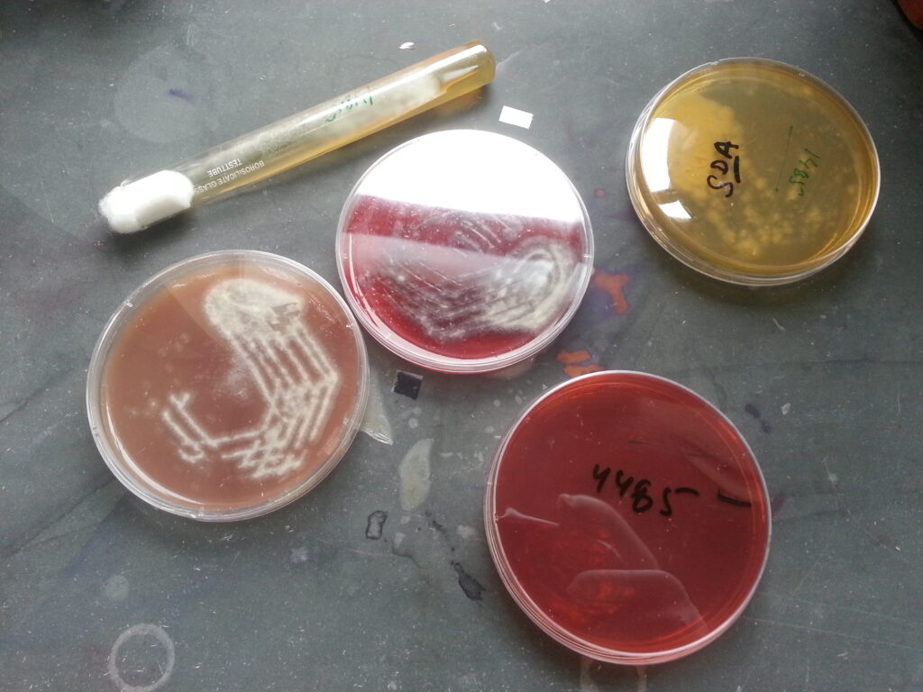 Fungal growth on MacConkey medium, blood agar, chocolate agar and SDA- tube and plate