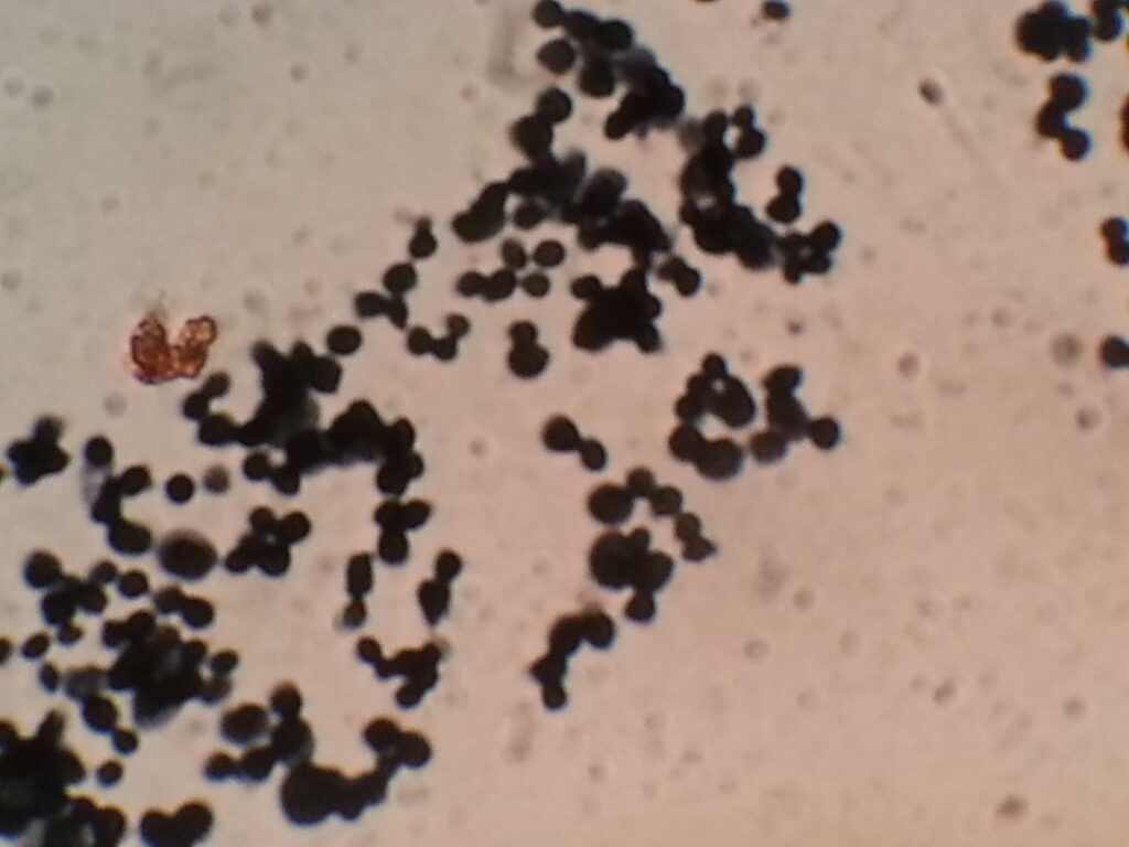 Fungal yeasts in methenamine- silver borate staining of culture