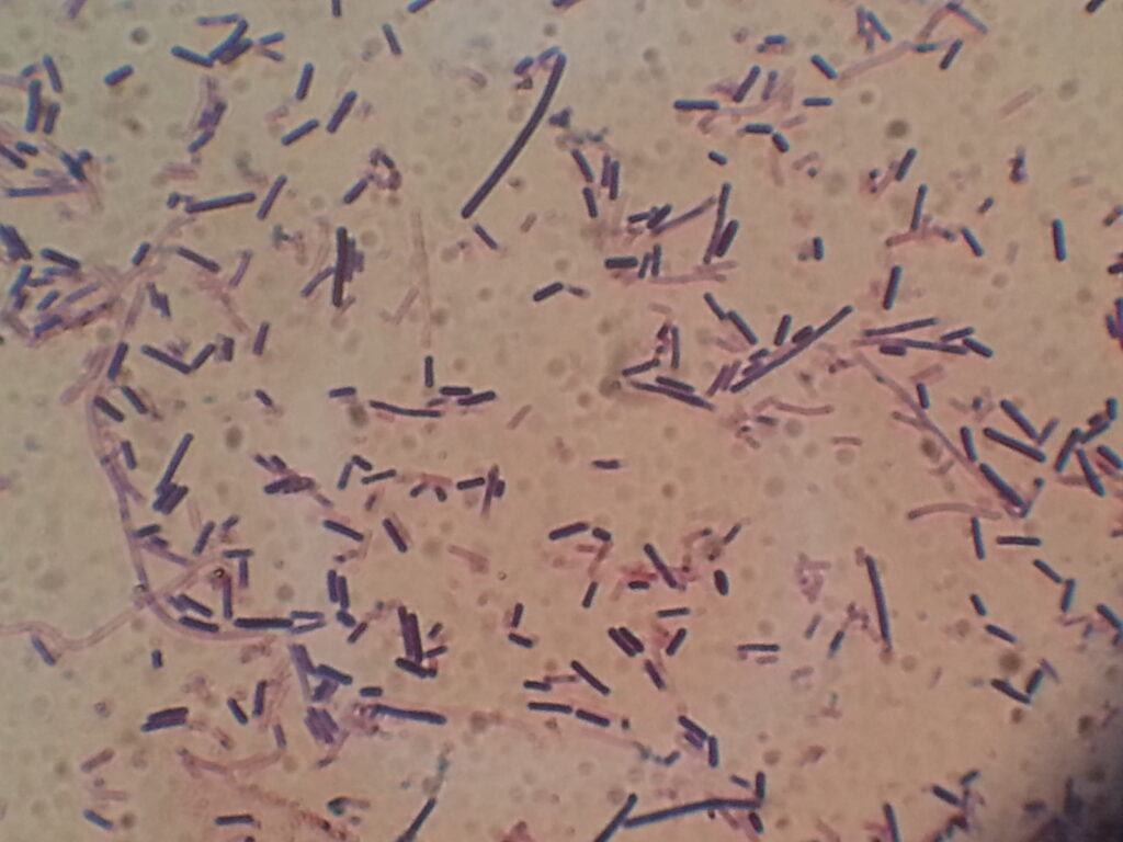 Gram positive rods of Bacillus species in Gram staining