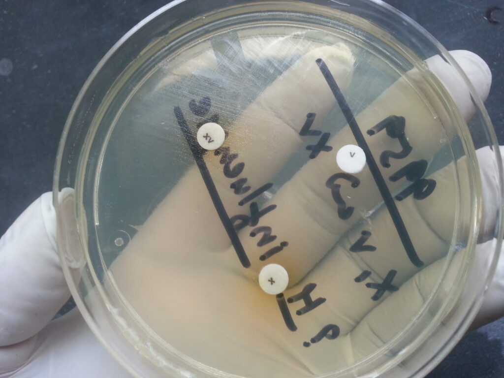 Haemophilus influenzae growth around XV disk on nutrient agar demonstration