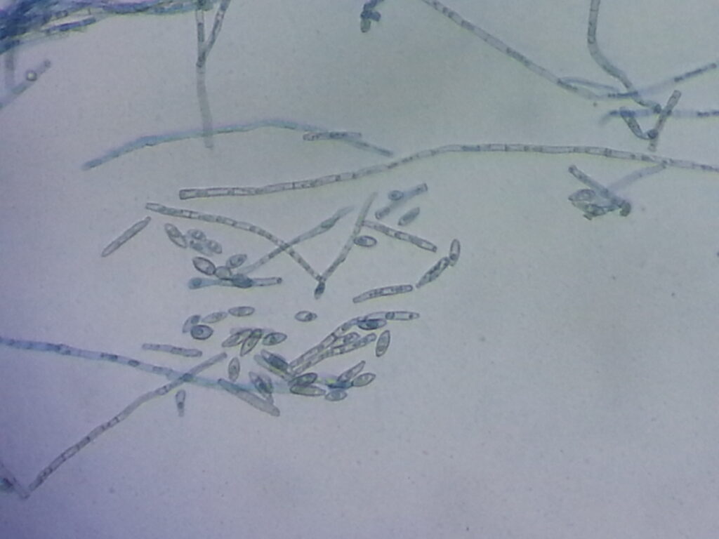 Hyphae, conidiophores, and conidia of Ochroconis species in LPCB preparation at high magnification