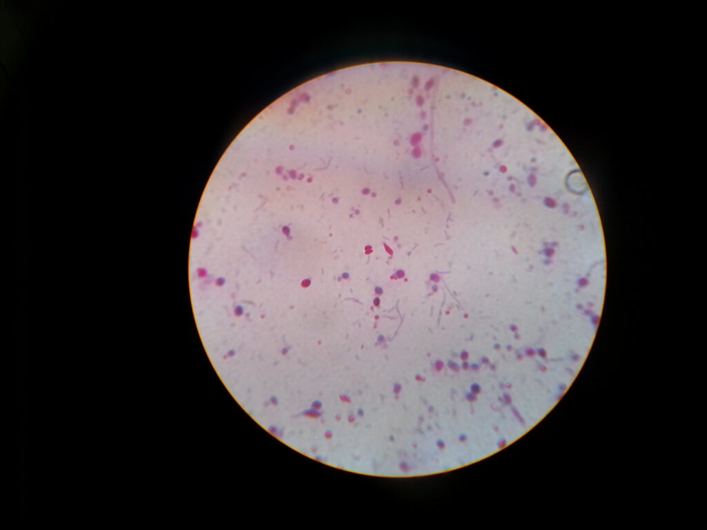 Kinyoun's stained smear of stool microscopy