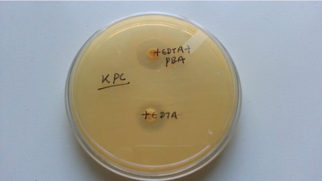 Klebsiella pneumoniae carbapenemase (KPC)-producing bacteria