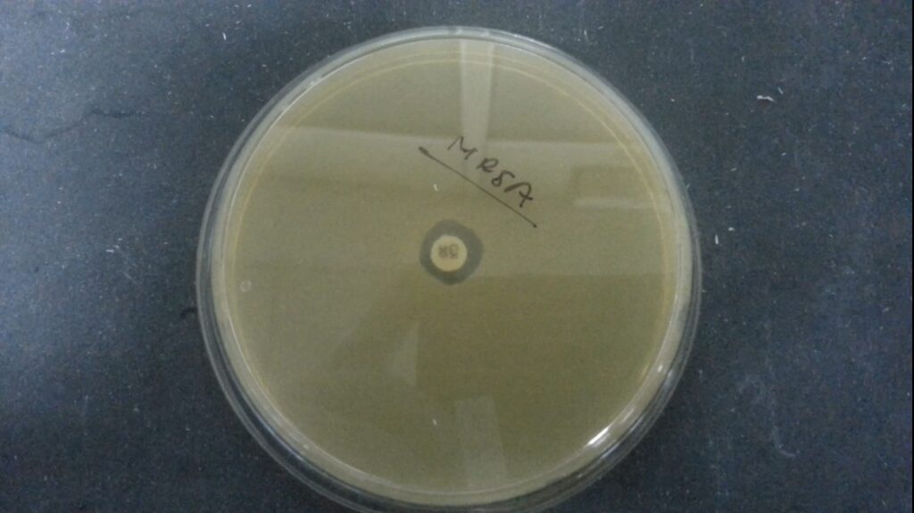 Methicillin-resistant Staphylococcus aureus (MRSA) strain