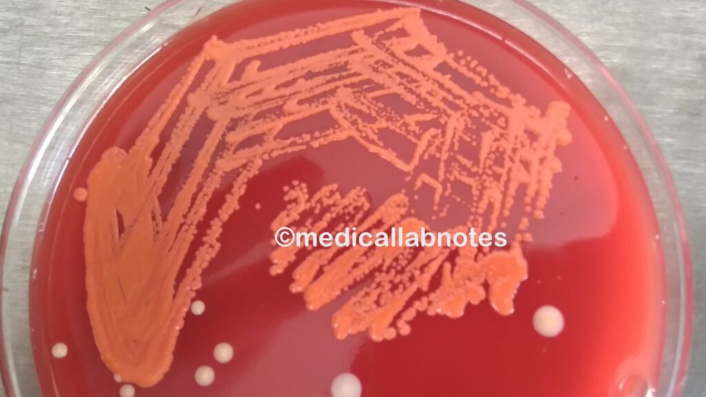 Micrococcus roseus growth on blood agar