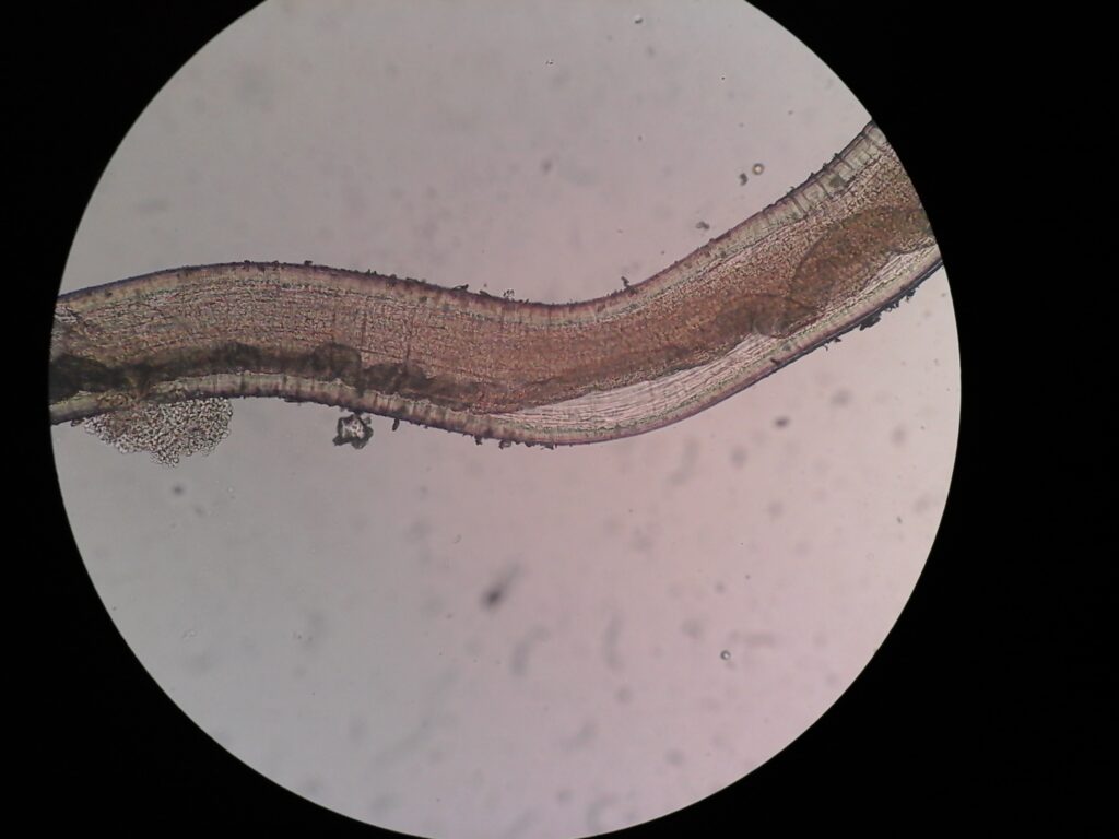 Microfilaria of eye  in microscopy