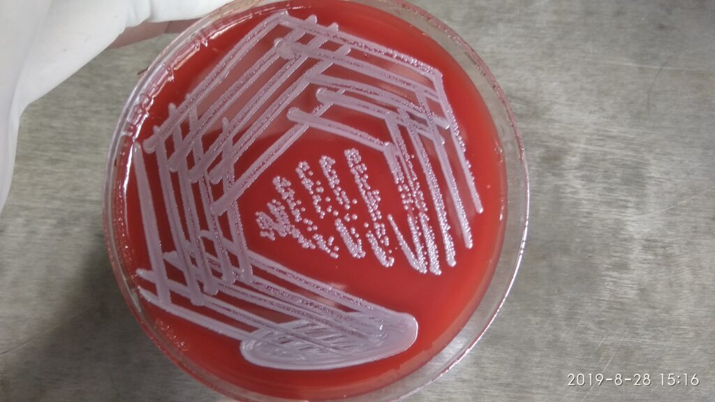 Non-pigmented strain of Staphylococcus aureus on blood agar