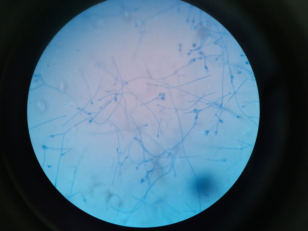 Paecilomyces in LPCB staining