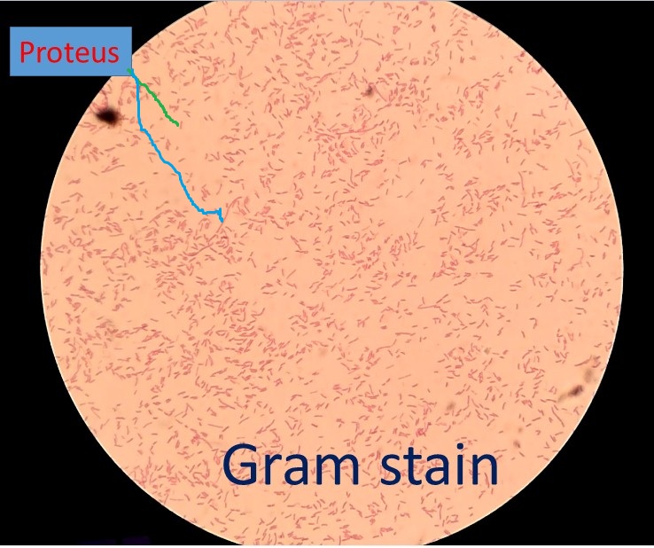 Proteus in Gram Staining