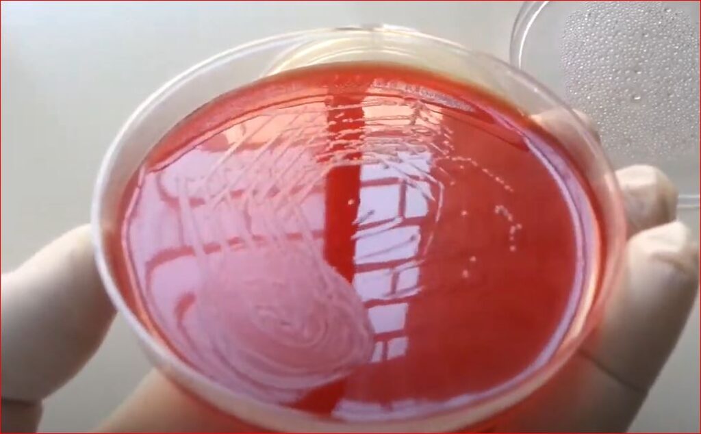 Salmonella Paratyphi growth on Blood Agar
