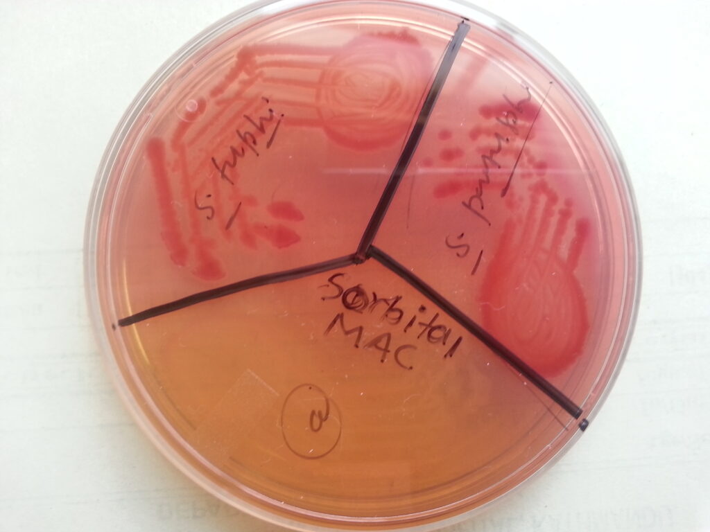 Salmonella Typhi and Paratyphi growth on Sorbitol MacConkey agar